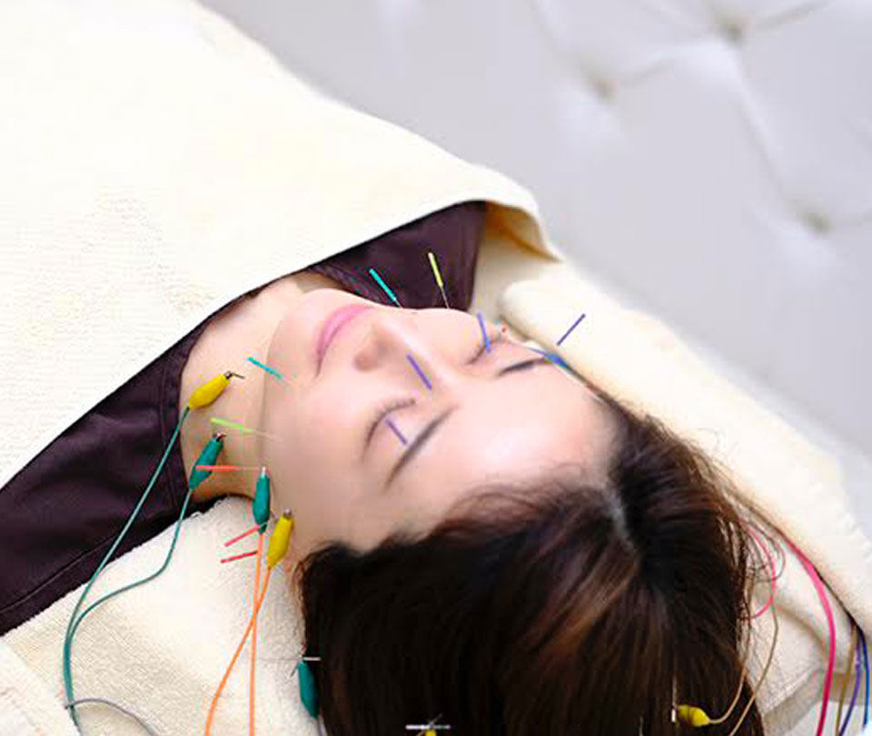 acumond式美容鍼 / お顔+頭の鍼