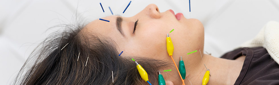 クイック美顔鍼コース